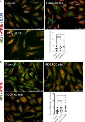 Role of mitochondria-bound HK2 in rheumatoid arthritis fibroblast-like synoviocytes